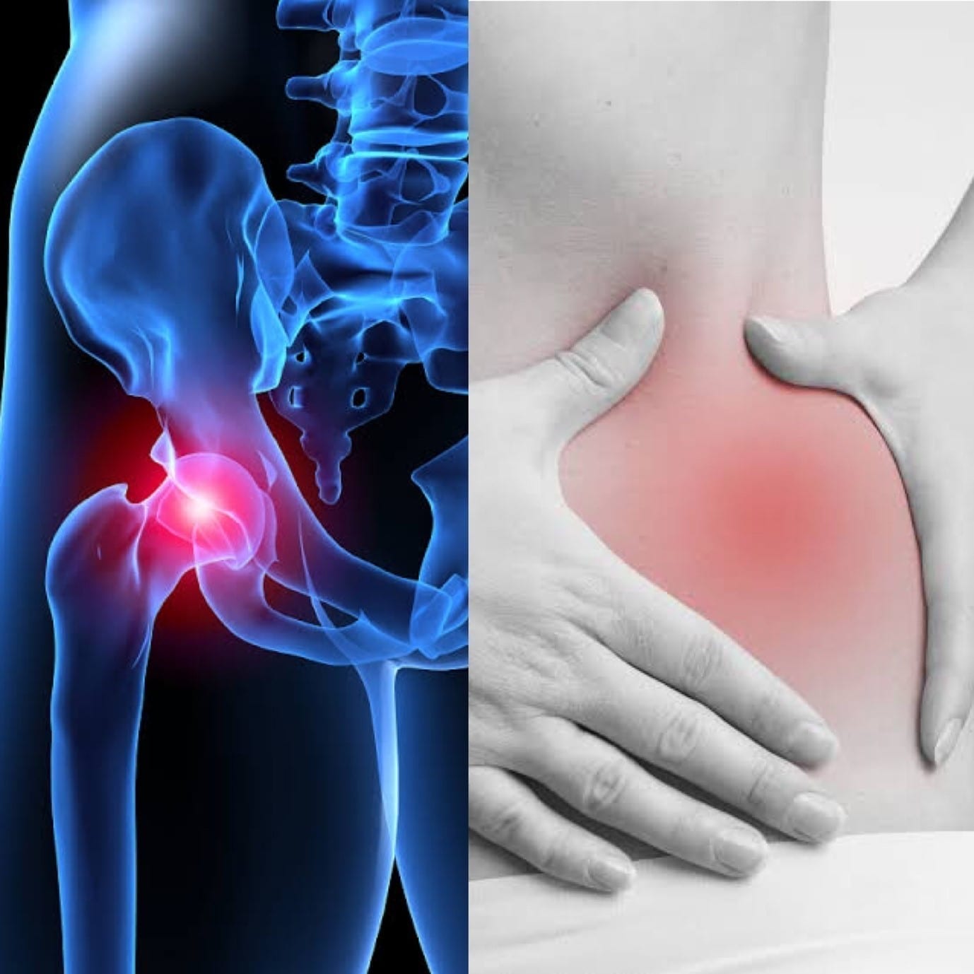 Bespoke Orthotics for Hip Pain